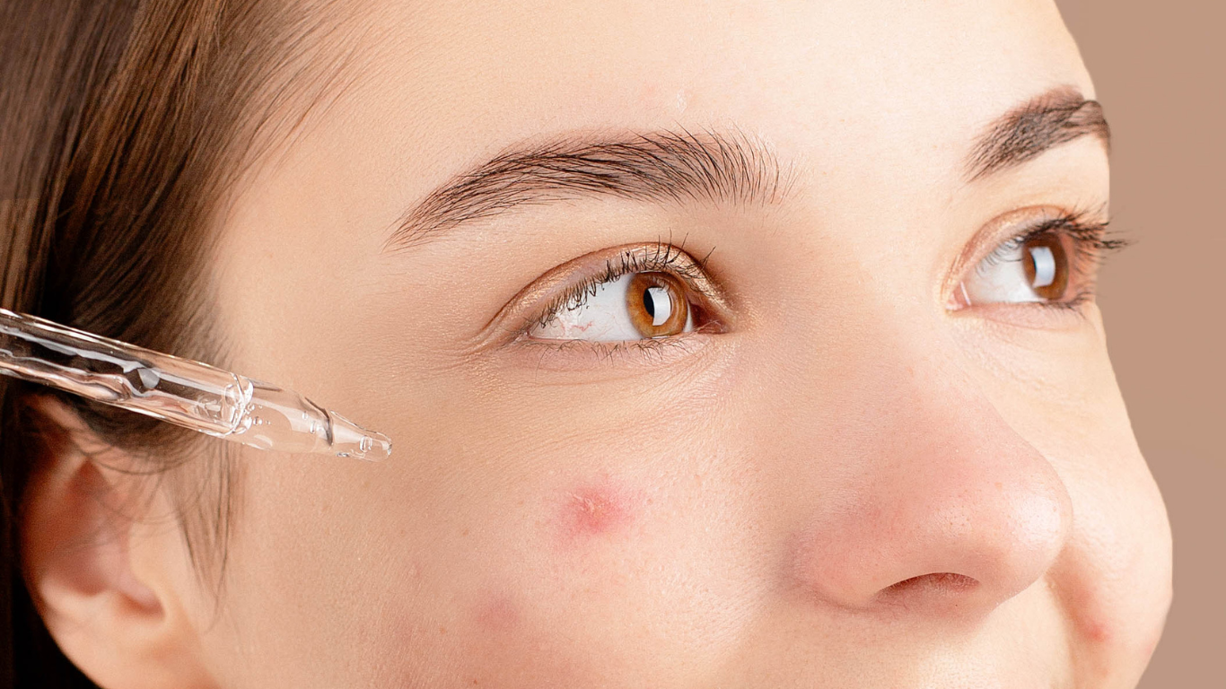 Ingredientes comedogénicos: qué son, cómo identificarlos y cómo evitarlos en tu rutina facial