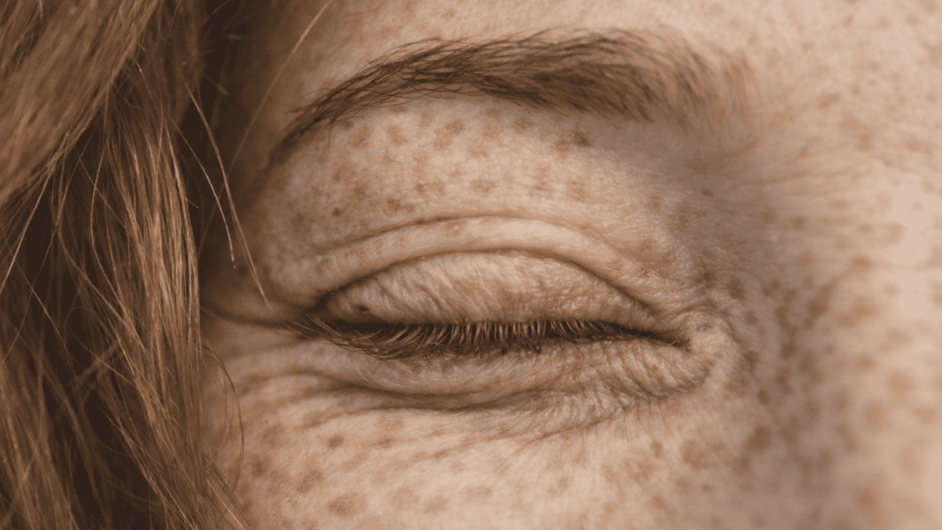 Hipercromías: qué son y por qué aparecen