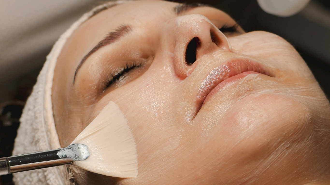 Melasma facial