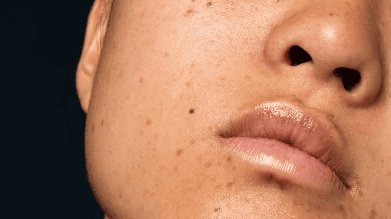 Piel apagada: causas, consecuencias y cómo recuperar la luminosidad de forma efectiva