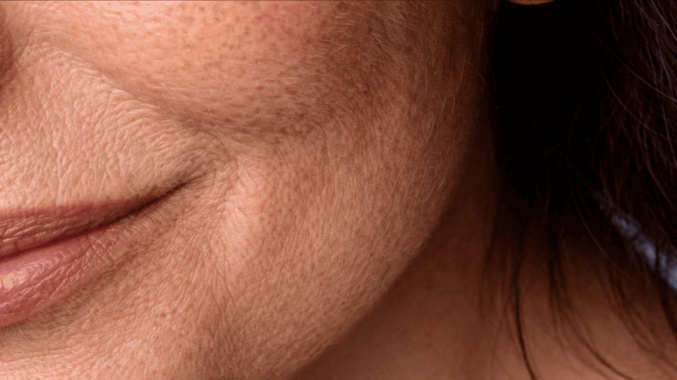 Textura Irregular de la Piel